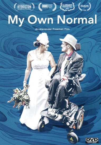 My Own Normal